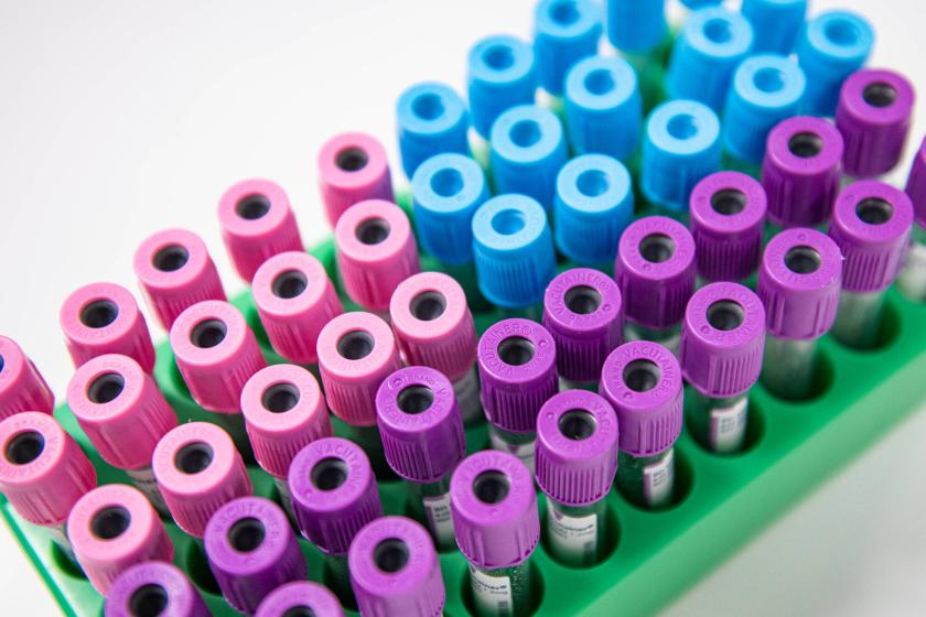 Vihreässä näyteputkitelineessä on riveittäin laboratoriokäyttöön tarkoitettuja verinäyteputkia. Putkien korkit ovat vaaleansinisiä, vaaleanpunaisia ja violetteja. Kuva on otettu yläviistosta lähikuvana, ja osa putkista näkyy terävänä etualalla, osa pehmeästi tarkentumattomana taustalla.