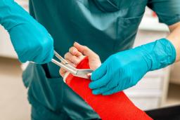 Kipsin leikkaus saksilla.