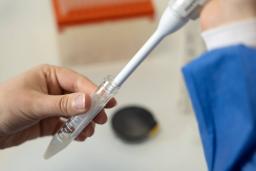 Spermanäytteen tutkimista Lisääntymislääketieteen yksikössä.