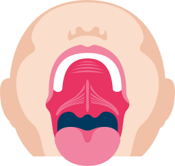 Piilosuulakihalkio