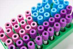 Vihreässä näyteputkitelineessä on riveittäin laboratoriokäyttöön tarkoitettuja verinäyteputkia. Putkien korkit ovat vaaleansinisiä, vaaleanpunaisia ja violetteja. Kuva on otettu yläviistosta lähikuvana, ja osa putkista näkyy terävänä etualalla, osa pehmeästi tarkentumattomana taustalla.